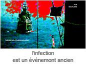 l’infection est un evenemont ancien